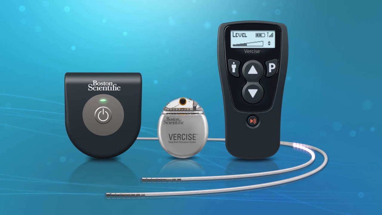 Deep Brain Stimulation MICC Technology