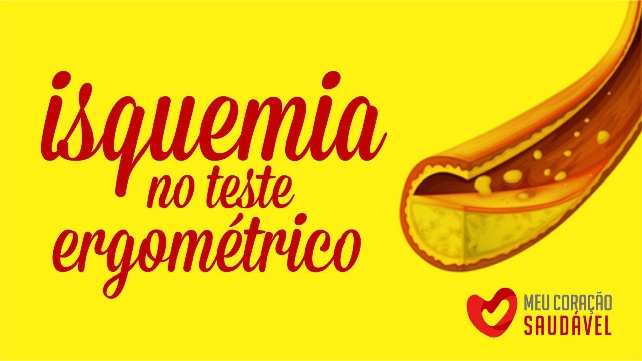 Teste ergom&eacute;trico com isquemia! Veja aqui o que voc&ecirc; precisa saber!