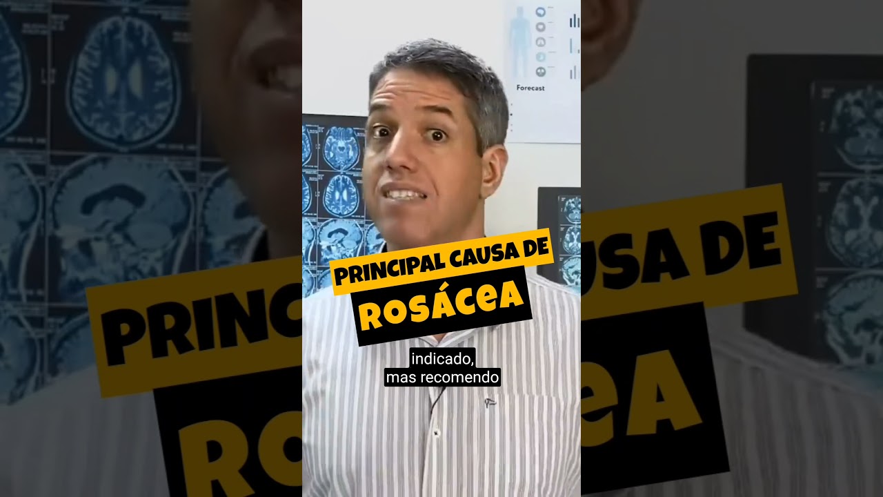 PRINCIPAL CAUSA DE ROS&Aacute;CEA - Dr Alain Dutra #shorts #rosacea