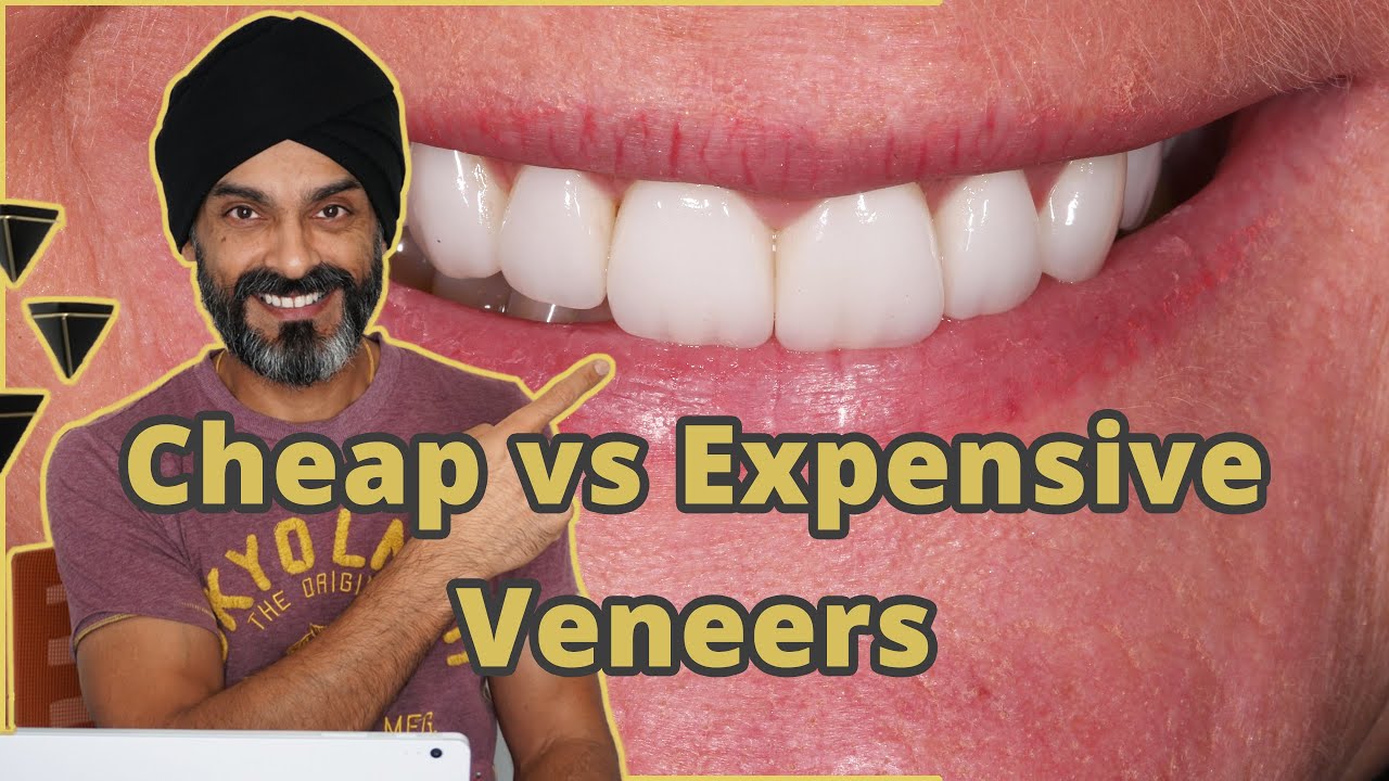 Expensive or Cheaper Porcelain Dental Veneers?