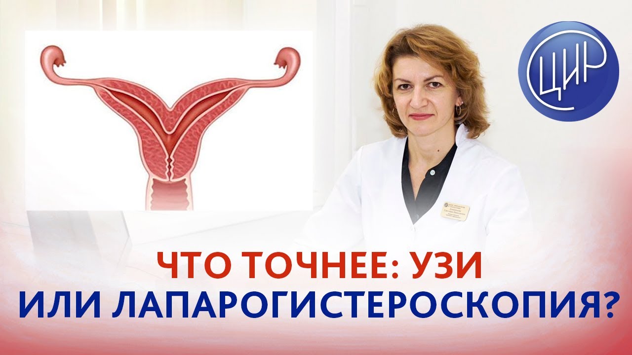 Матка седловидная или с перегородкой, как отличить? УЗИ или лапарогистероскопия, что точнее?