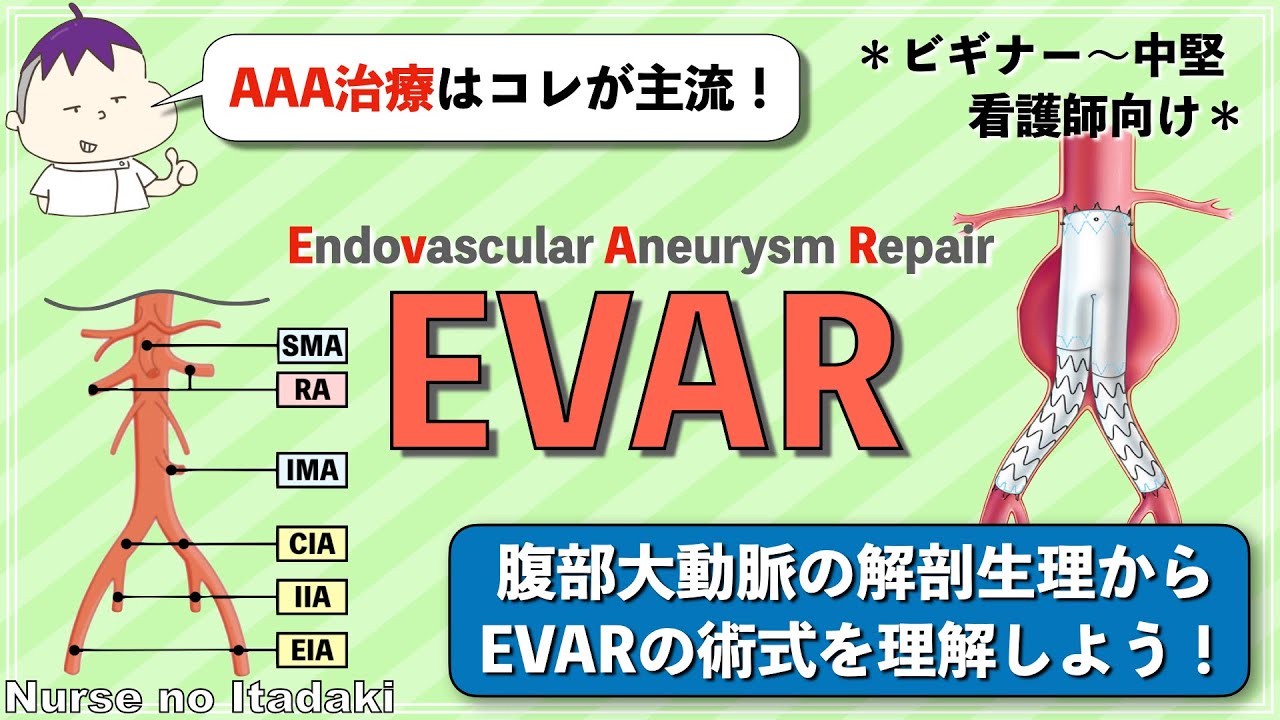 【EVARを解剖から理解しよう！】AAA治療の主流であるEVARの術式を学ぼう！