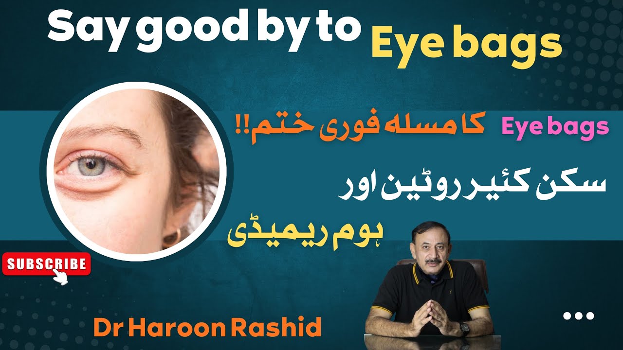 Say Good By To Eye Bags[Eye Bags کا مسئلہ فوری حتم!!سکن کئیر روٹین اور ہوم ریمیڈی