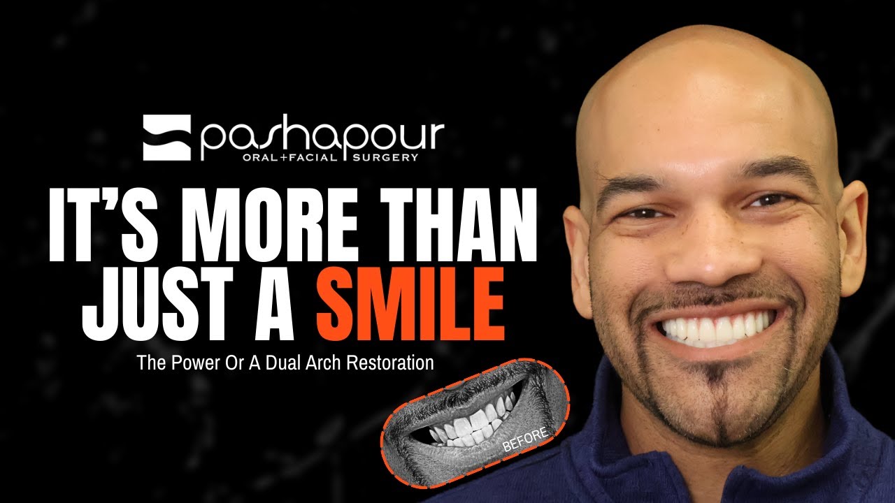 Restoring a Smile - The Transformative Power Of Dual Arch Restoration