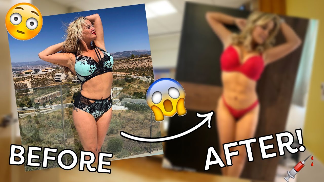 KERRY KATONA: I got ANOTHER BOOB JOB! 😱 (SCARY!!) 💉😳