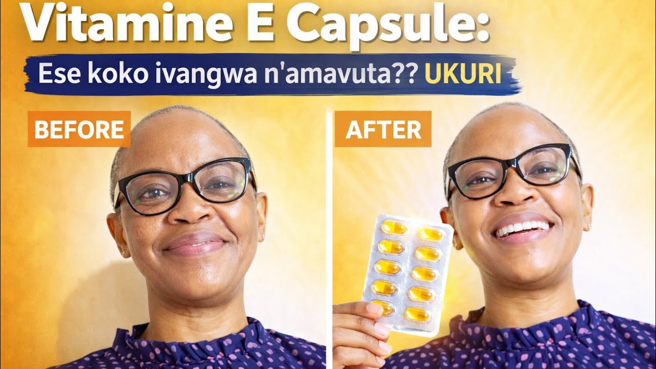 👉 “Vitamine E Capsule: Ibanga ry’uruhu rwiza rudasaza!”