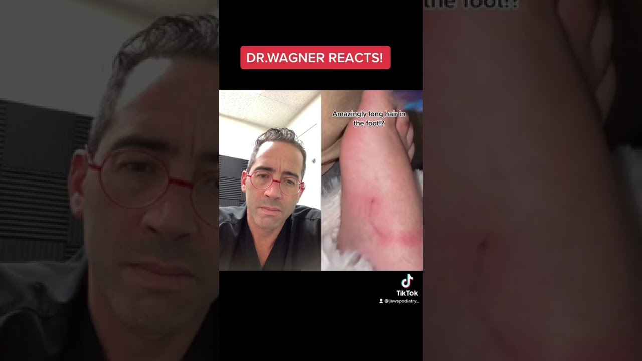 LONGEST INGROWN HAIR? 😳