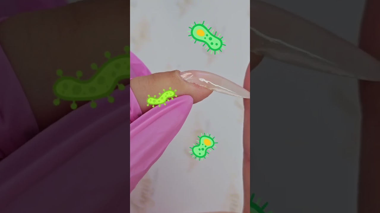 🦠Wieso du Liftings zeitnah entfernen solltest🦠 Nailshop &middot; nailmondo #nails #nailtutorial #liftings
