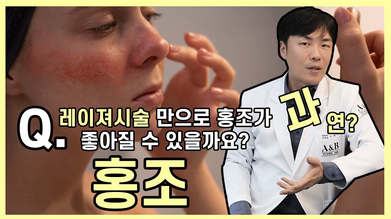 홍조, 레이저 시술로 정말 치료될까?? | 100점짜리 홍조 치료 방법 | 홍조 관리법 | 연세에이앤비피부과 이해진 원장