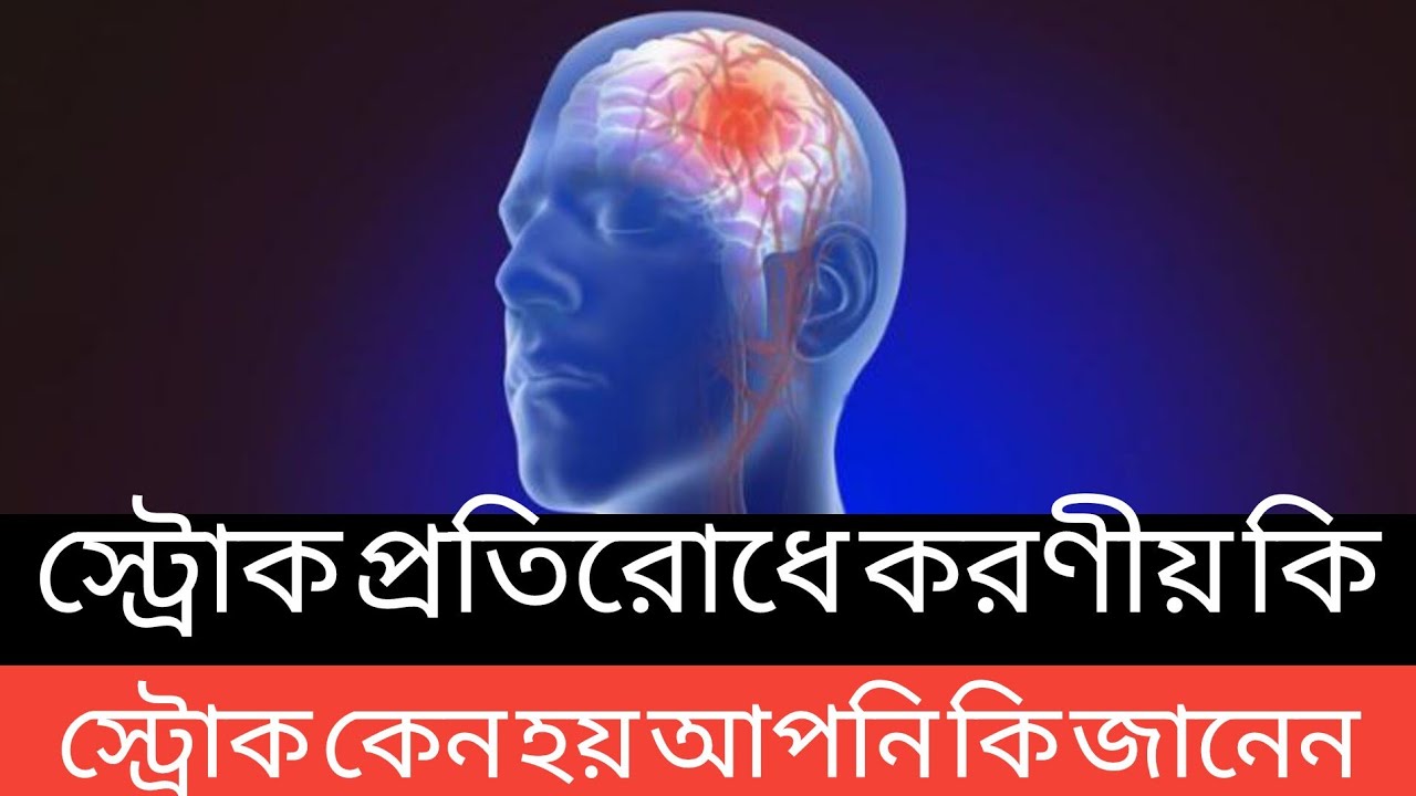 স্ট্রোক কেন হয় আপনি কি জানেন? স্ট্রোক প্রতিরোধের উপায় কি।