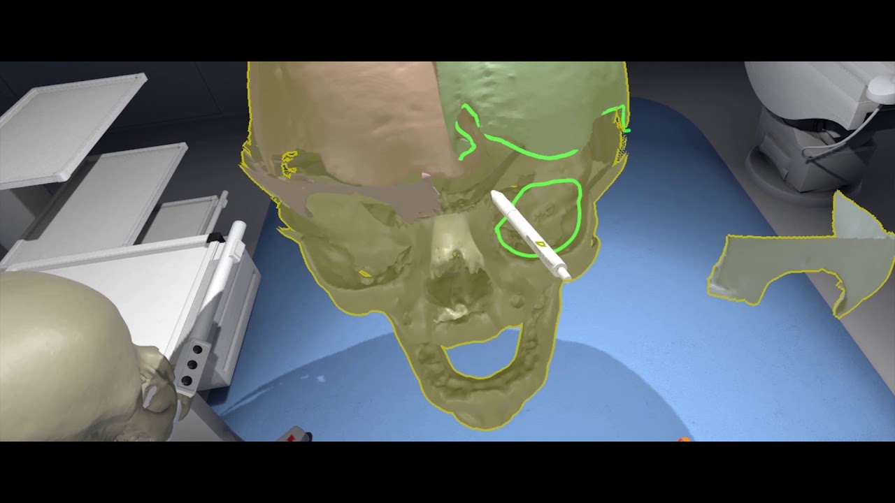 ImmersiveTouch Launches New Solutions for Personalized Virtual Reality Surgical Simulation (Video 1)