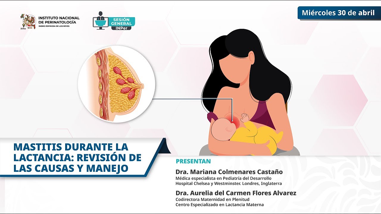 MASTITIS DURANTE LA LACTANCIA: REVISIÓN DE LAS CAUSAS Y MANEJO