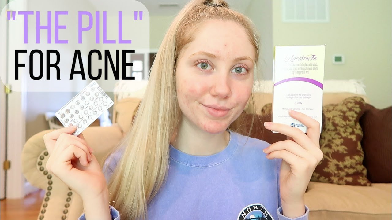 Taking Birth Control "the pill" for Acne! | First month!
