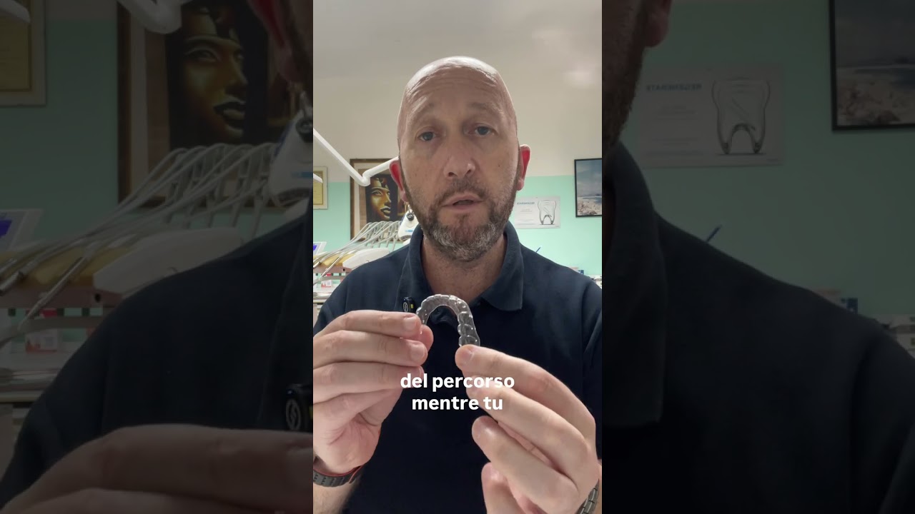 Apparecchio invisibile: come funziona davvero il trattamento con allineatori 🧐
