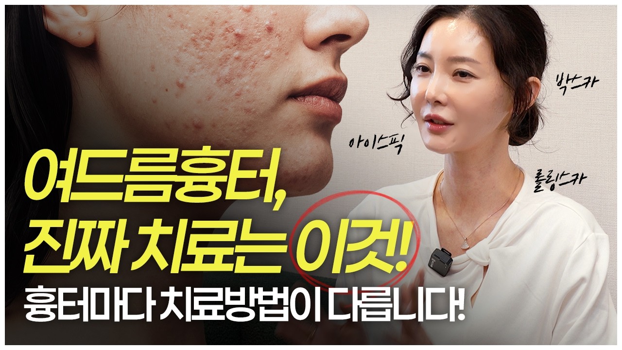 여드름흉터 치료,  대부분 이래서 실패합니다 😢ㅣ여드름흉터 진짜 치료는 이것‼️