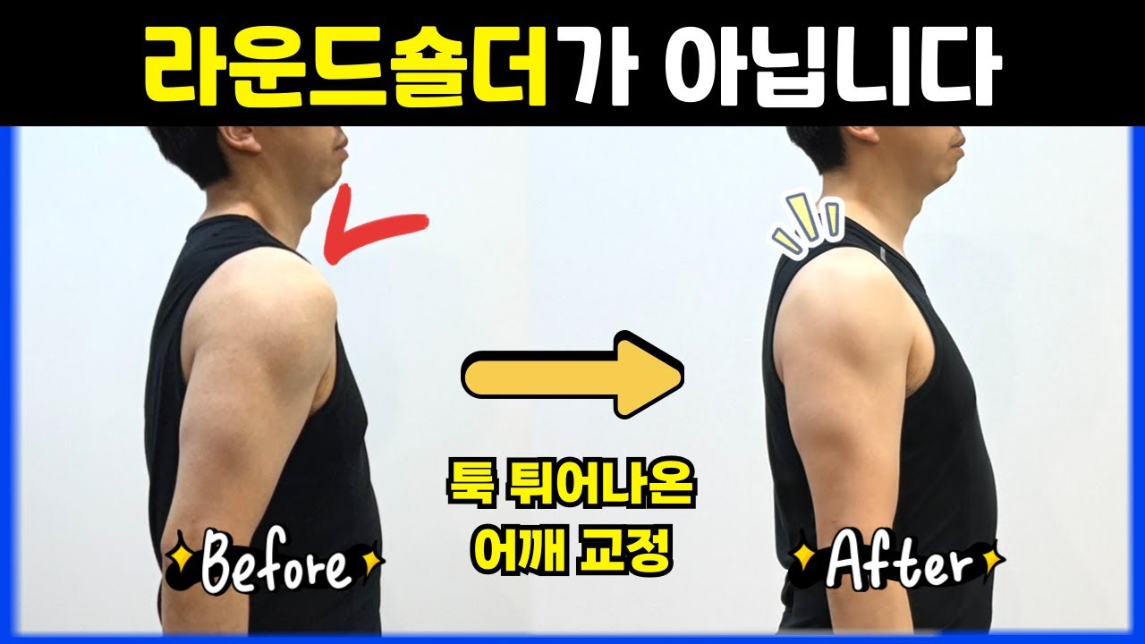 여기가 튀어나오면 어깨 아작납니다! 상완골전방활주 자가진단 & 교정 운동