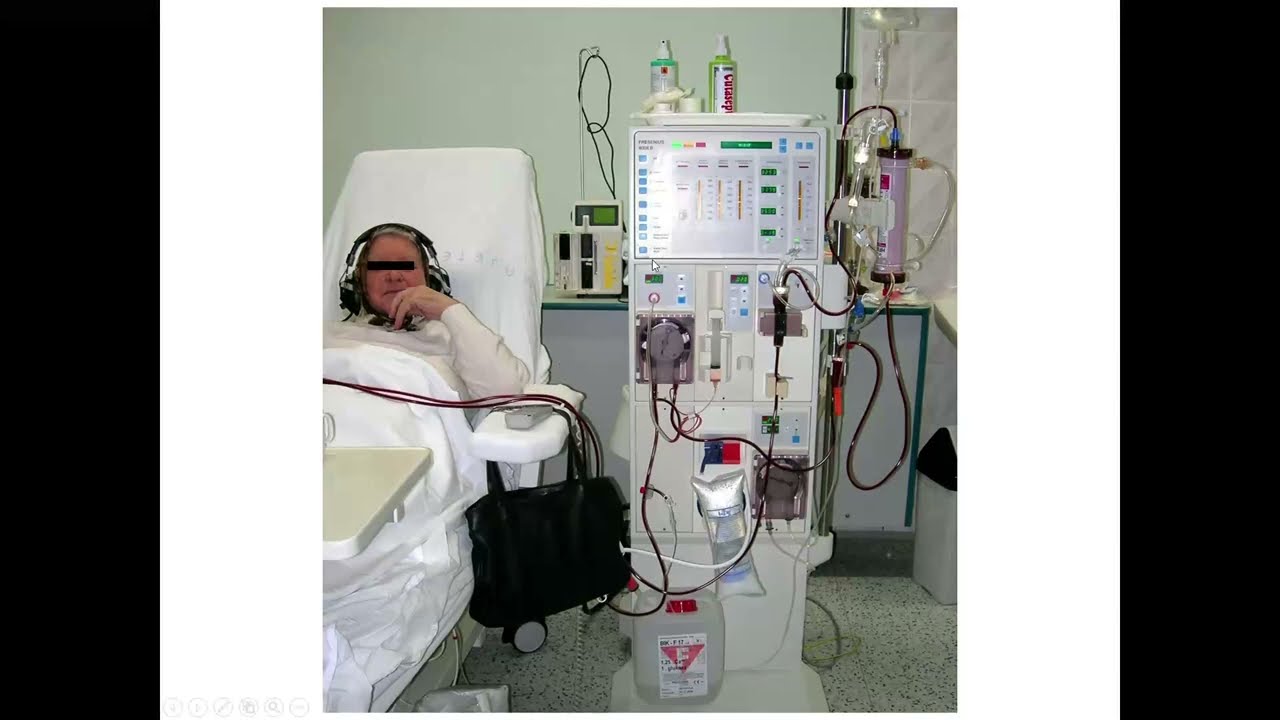 Náhrada funkce ledvin - prof. MUDr. T. Reischig, Ph.D.