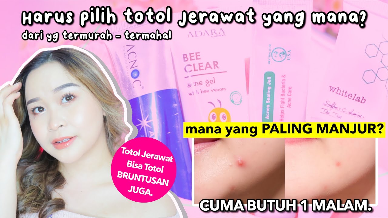 BATTLE 5 TOTOL JERAWAT (mana yang paling CEPAT TUNTASIN jerawat?)