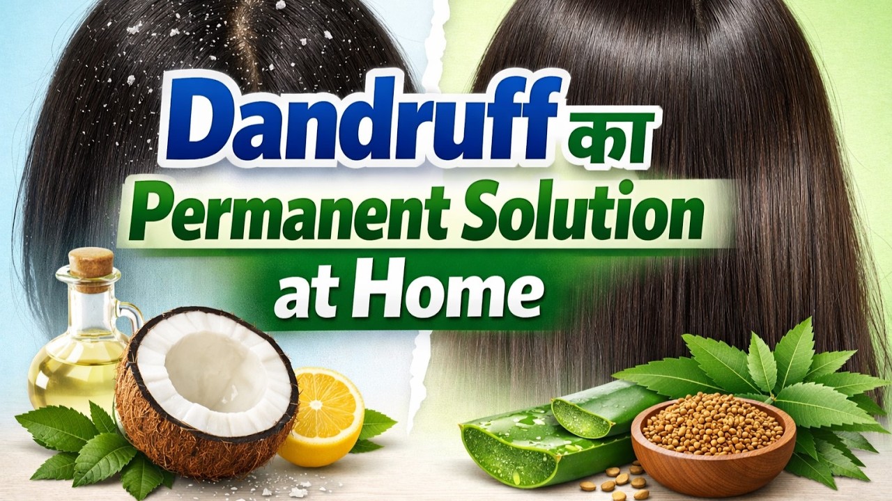 Dandruff (रूसी) का Permanent Solution at Home | रूसी जड़ से खत्म (Men & Women)