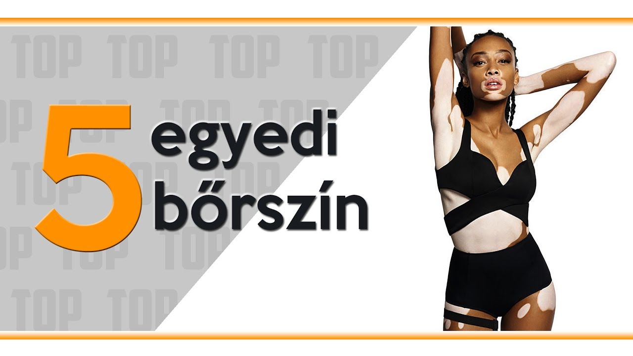 [TOP 5] LEGK&Uuml;L&Ouml;NLEGESBB BŐRSZ&Iacute;N ■  Emberek, akik egyedi, ritka bőrsz&iacute;nnel rendelkeznek [LEG]
