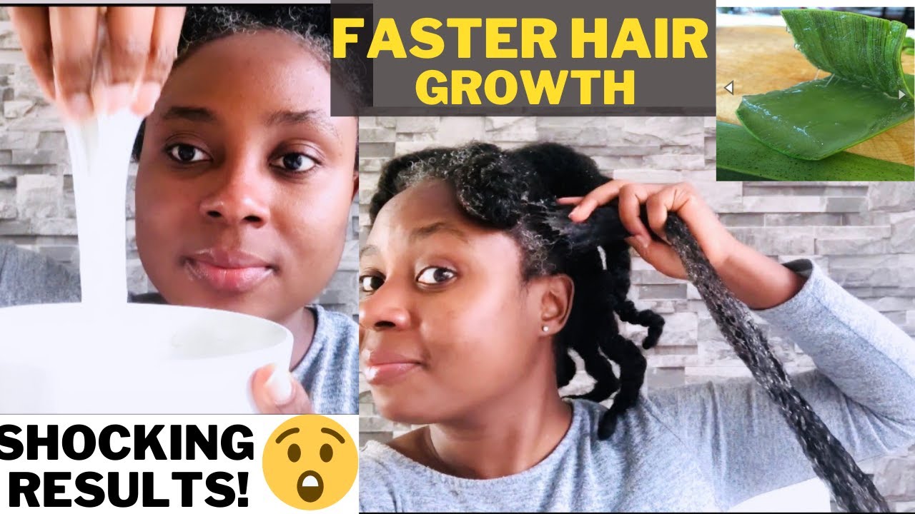 Overnight Aloe Vera Treatment for Extreme Hair Growth || Shocking Results!!