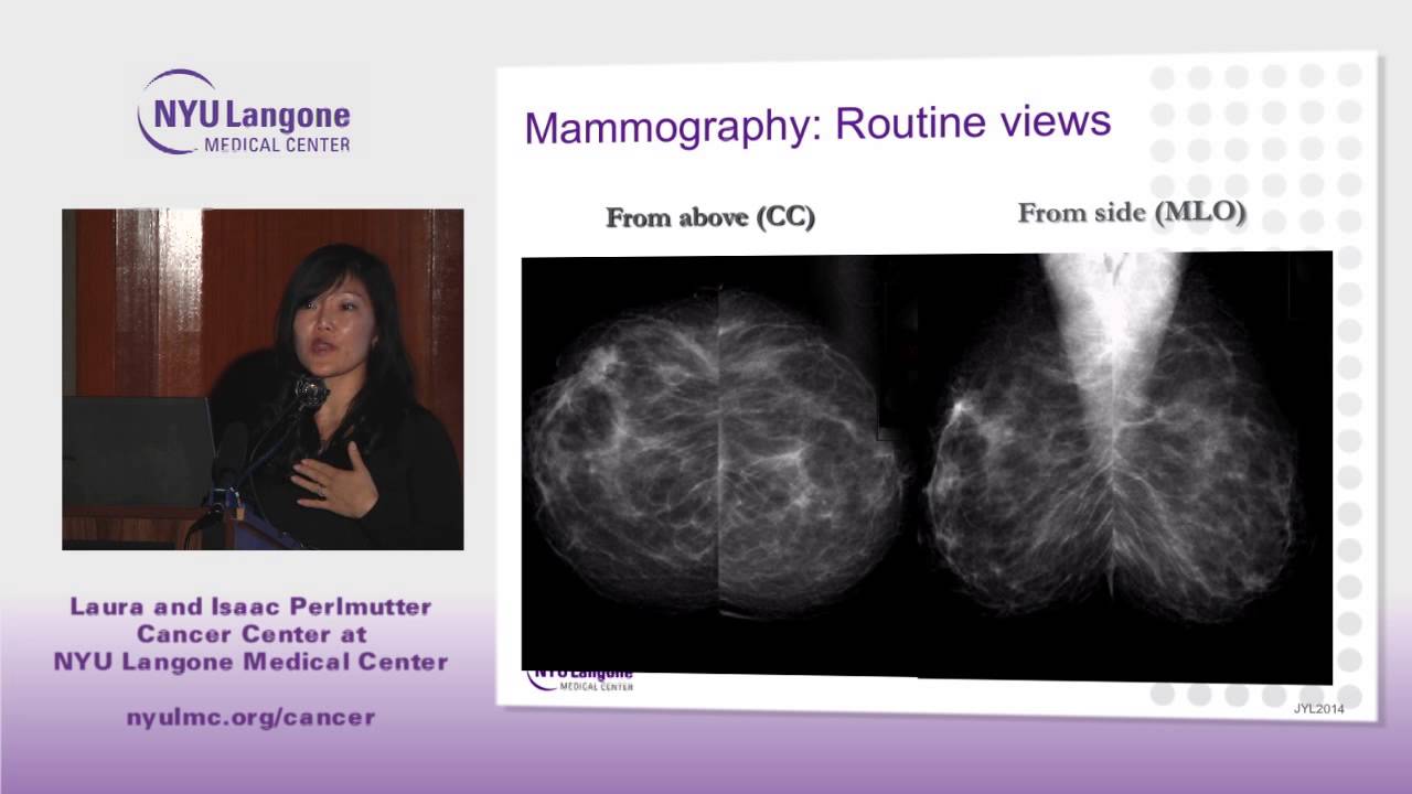 Breast Cancer Through the Looking Glass: A Radiology Perspective