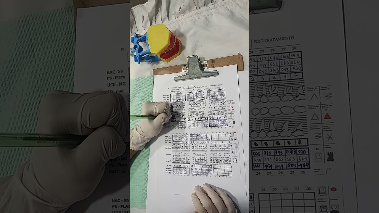 llenado del periodontograma