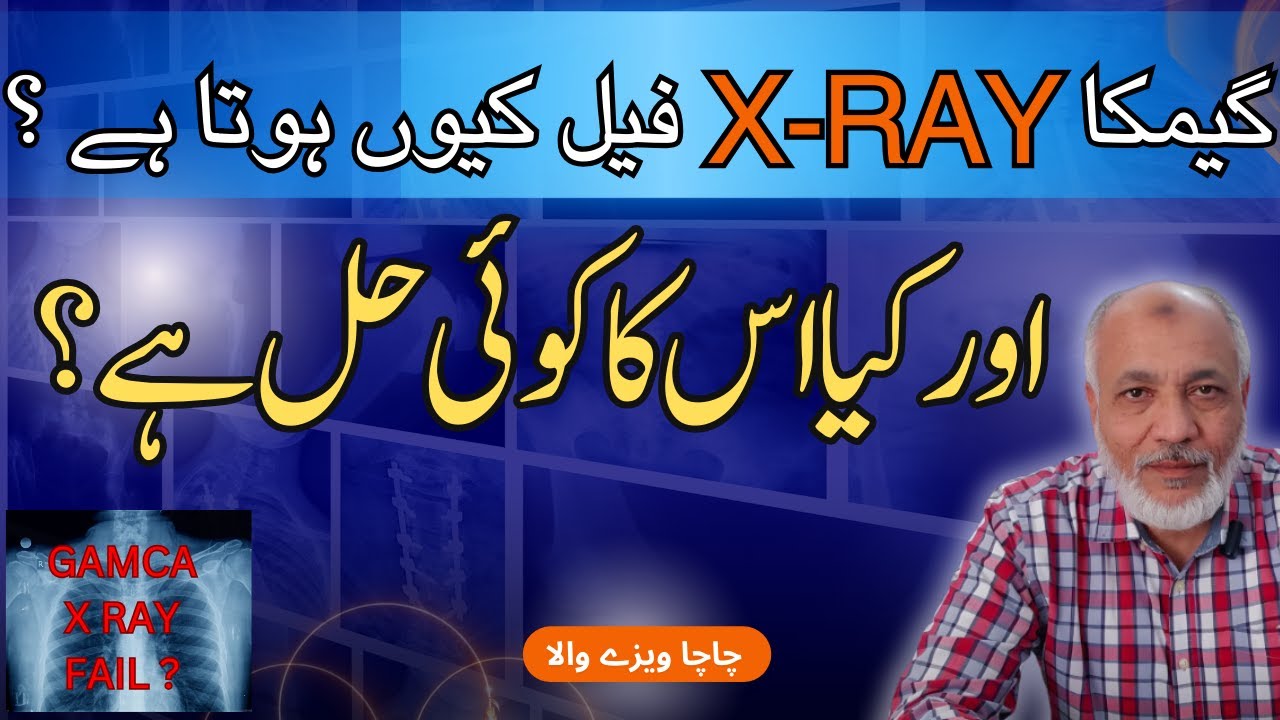 GAMCA X-ray unfit | GAMCA X-ray | GAMCA chest X-ray | گیمکا ایکس رے فیل کیوں ہوتا ہے ؟