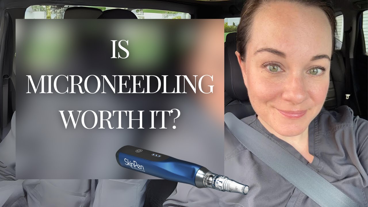 Microneedling with SkinPen Treatment | Before and After Results