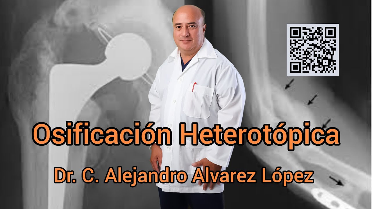 Osificacion heterotopica