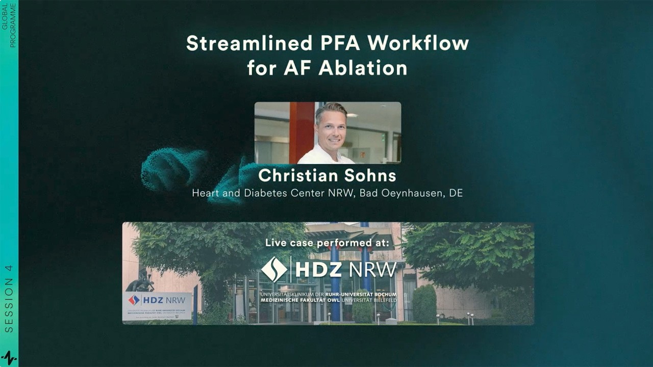 RIO 2025 | Live Case & Discussion: Streamlined PFA Workflow for AF Ablation