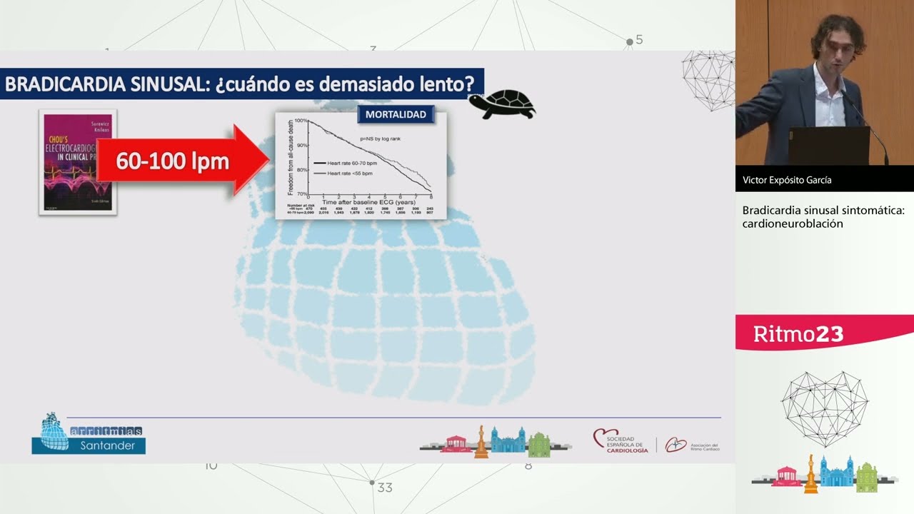 Arritmias en el deportista