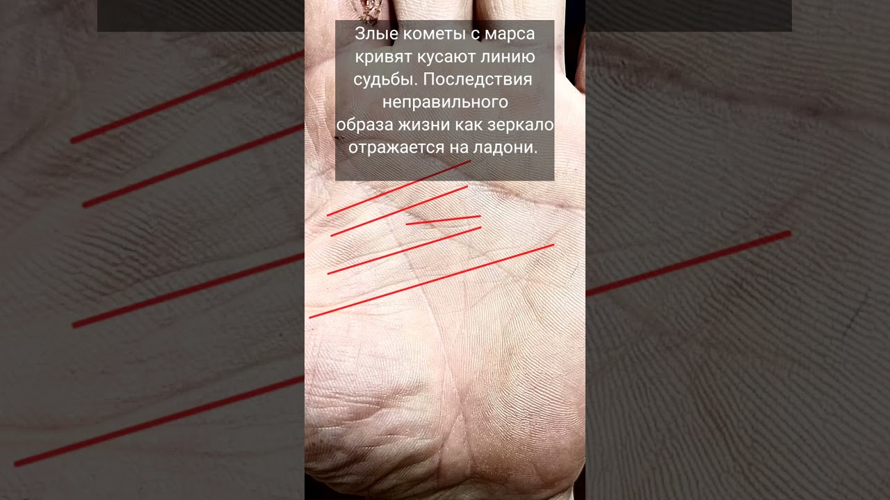 на парня заводят очередное уголовное дело за наркотики. #хирология