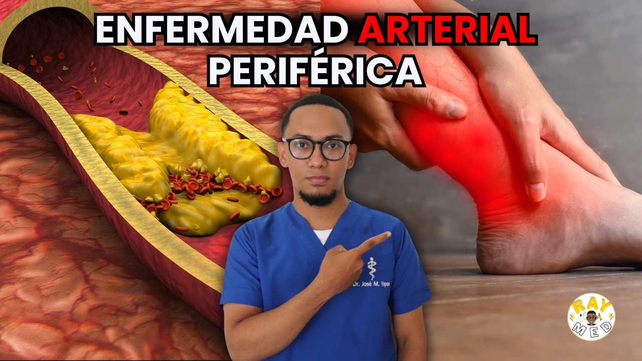 Enfermedad Arterial Periférica: Diagnóstico y tratamiento en menos de 10 minutos!
