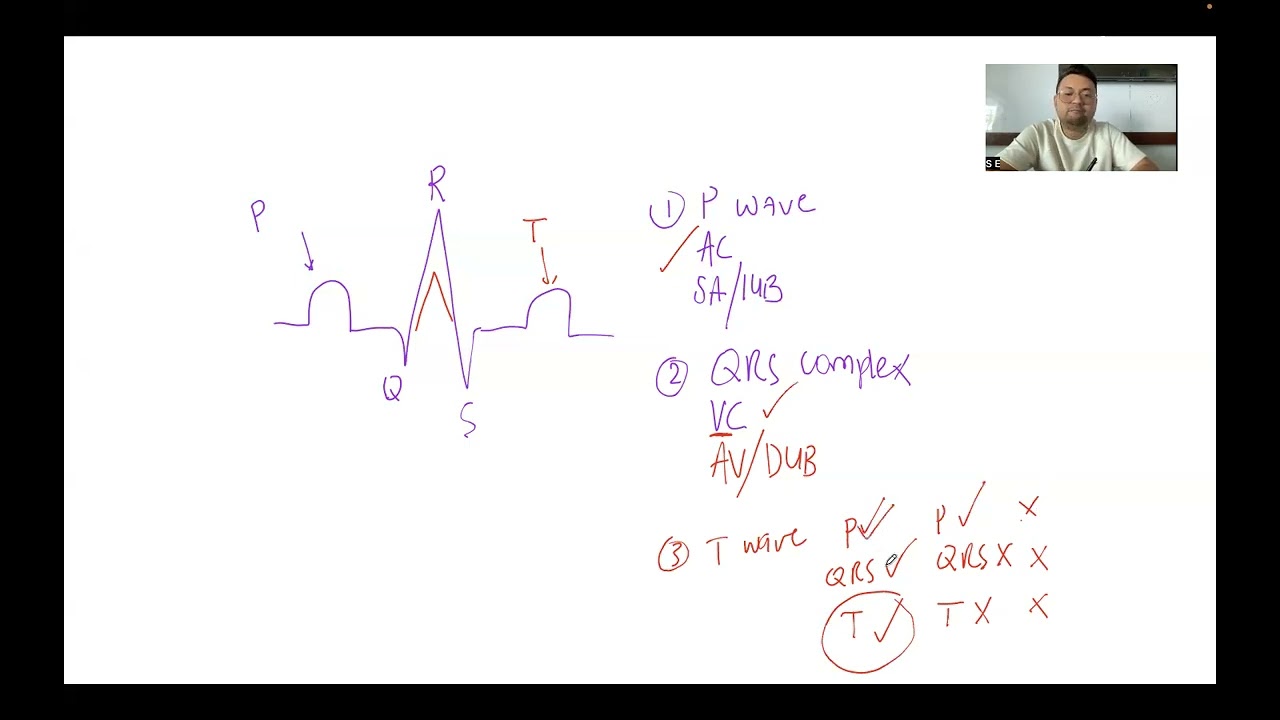 CARDIO Series: ECG (Electrocardiogram) - PART 1
