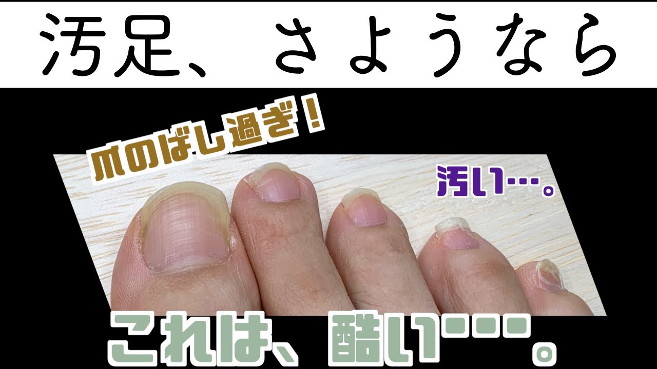 すぐできる！足のネイルケア♪自宅で簡単になるべく家にあるものでフットネイルケアをやってみた。