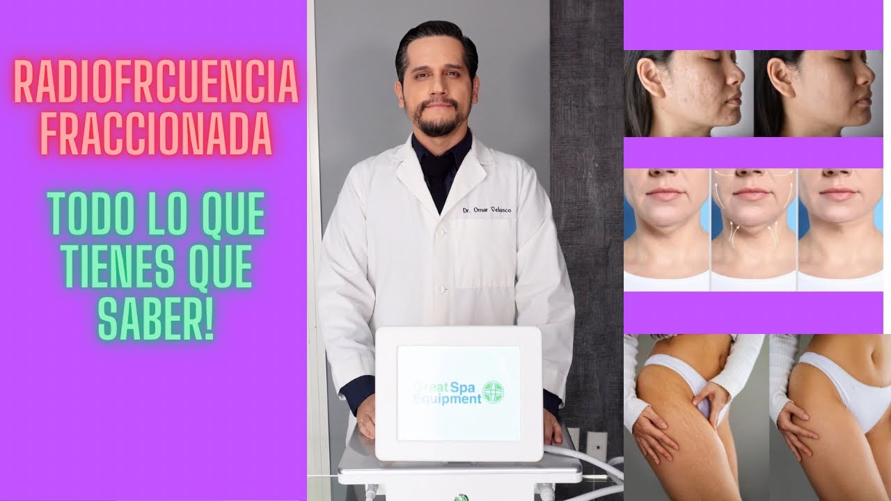 LO MÁS IMPORTANTE DE RADIOFRECUENCIA FRACCIONADA