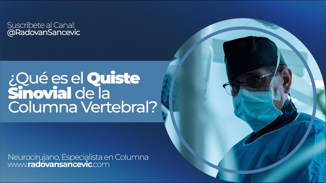¿Qué es el QUISTE SINOVIAL de la Columna Vertebral?