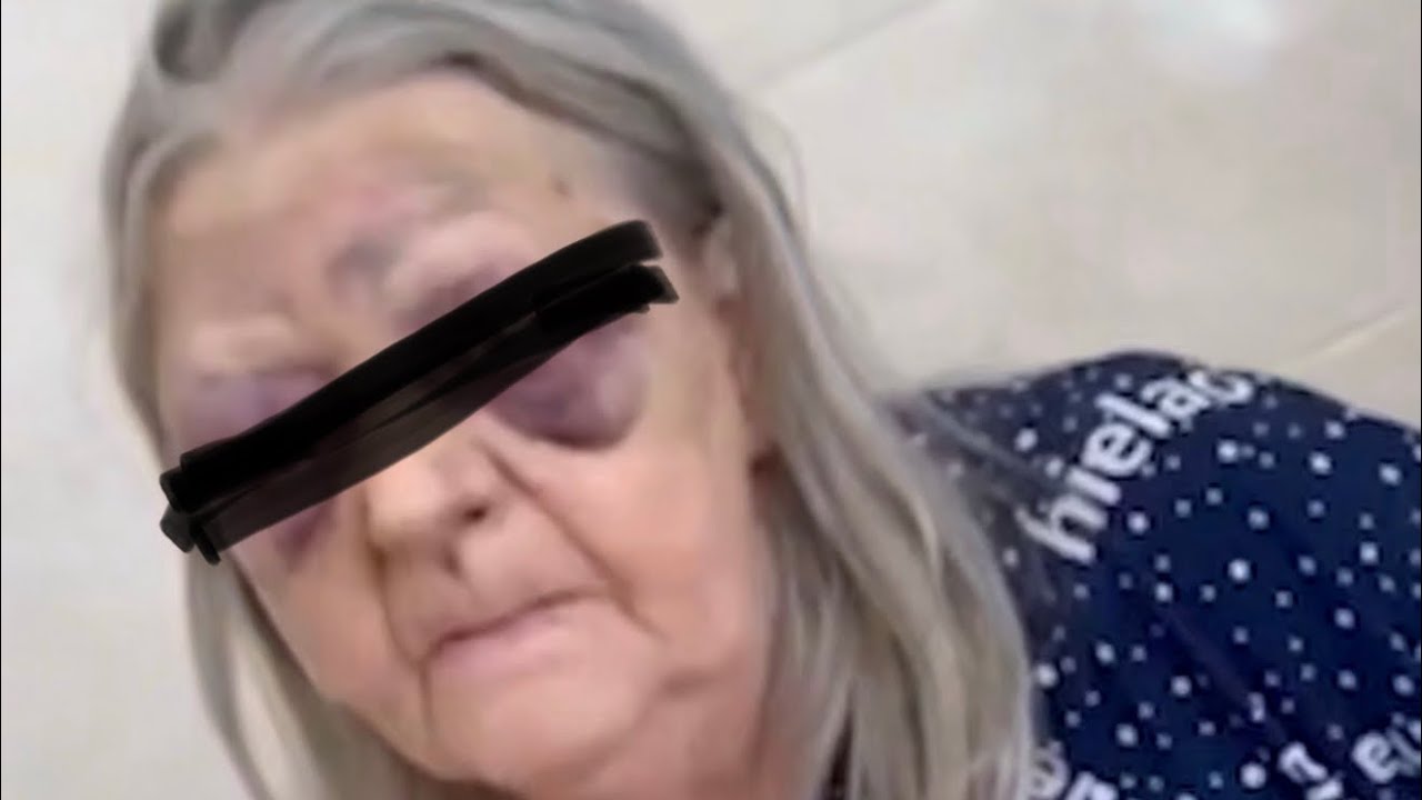 Пенсионерку зверски избили в больнице в Кемеровской области 