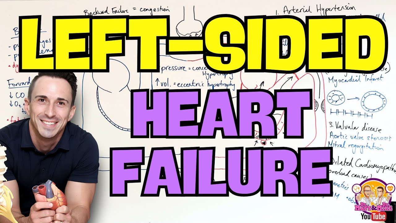Left Sided Heart Failure