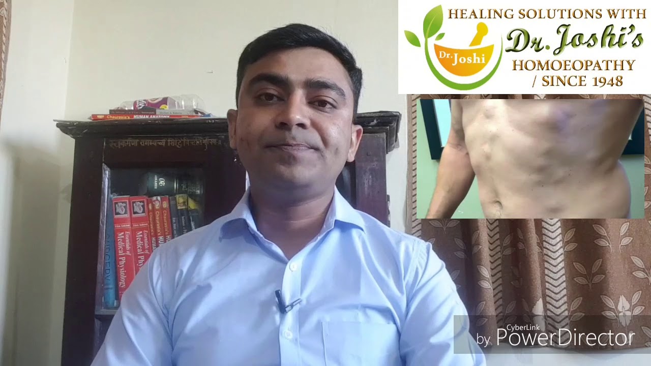 Lipoma? Homeopathic Medicine For lipoma!