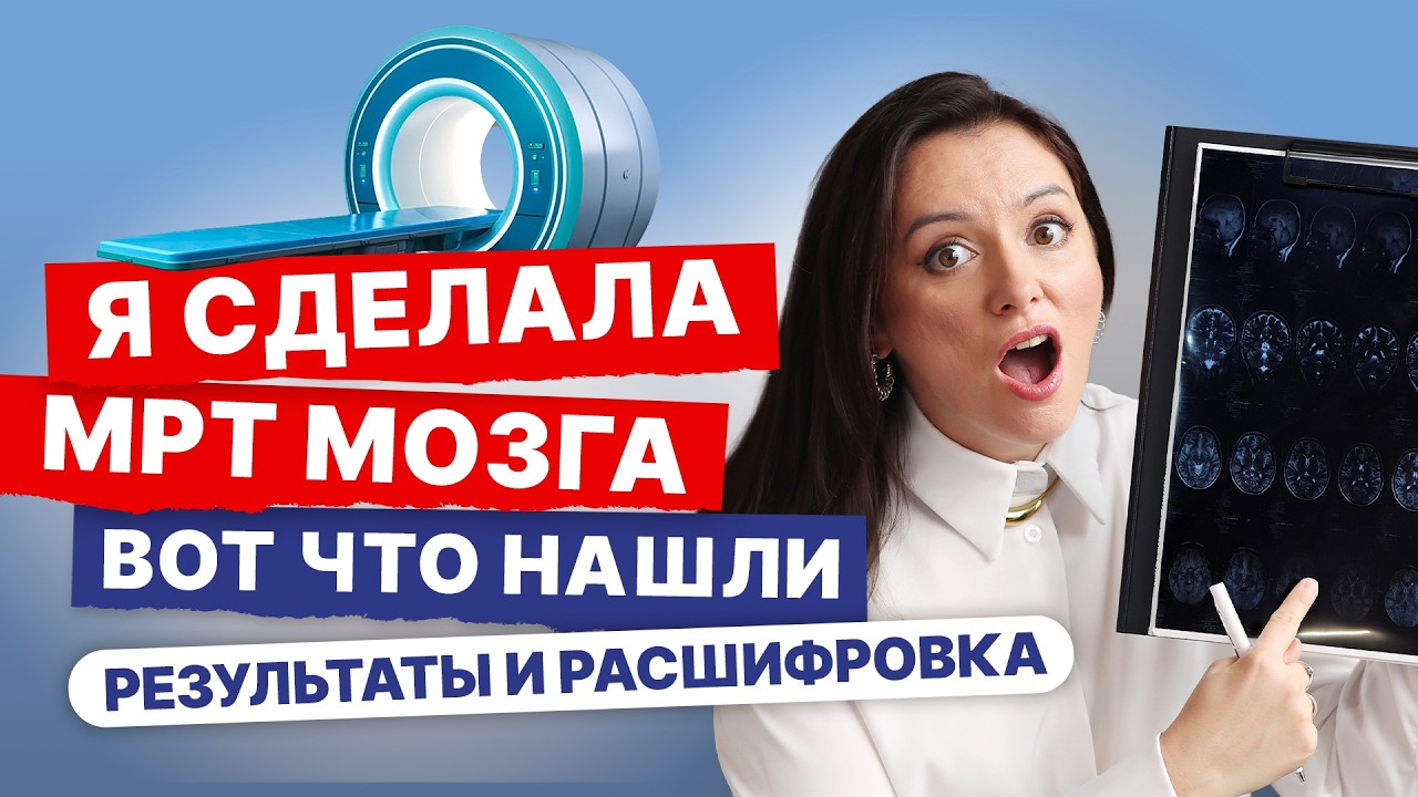 Я этого не ожидала: что показало МРТ мозга после беременности? Разбираю свои результаты как невролог