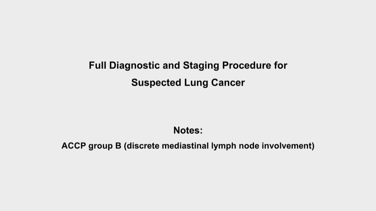 EBUS training video - full diagnostic and staging procedure for suspected lung cancer
