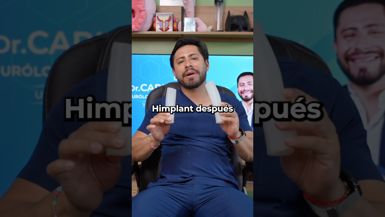 ¿Como se siente el HIMPLANT? El procedimiento para hacerlo más grande y más grueso ahora en México