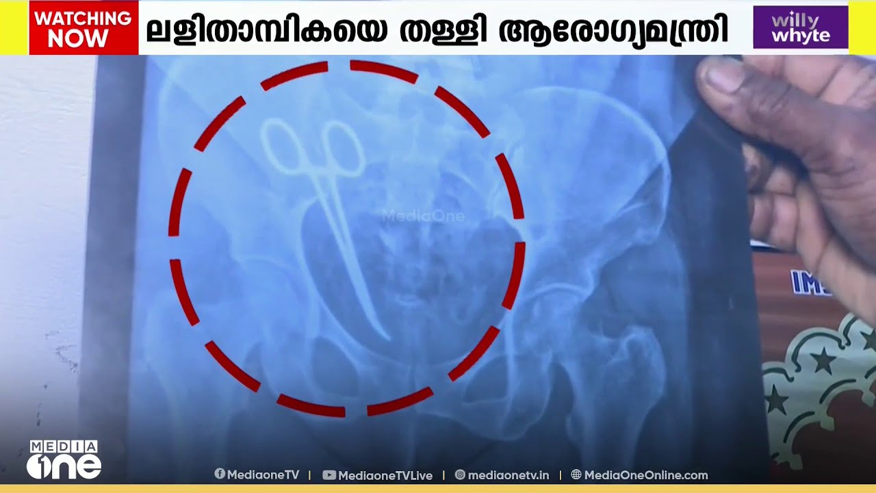 വയറ്റിൽ കത്രിക: ശസ്ത്രക്രിയ ചെയ്തത് ഡോ. ഷാഹിദയെന്ന് സൂപ്രണ്ട്; വീഴ്ചയെ ന്യായീകരിച്ച് ഡോ. ലളിതാംബിക