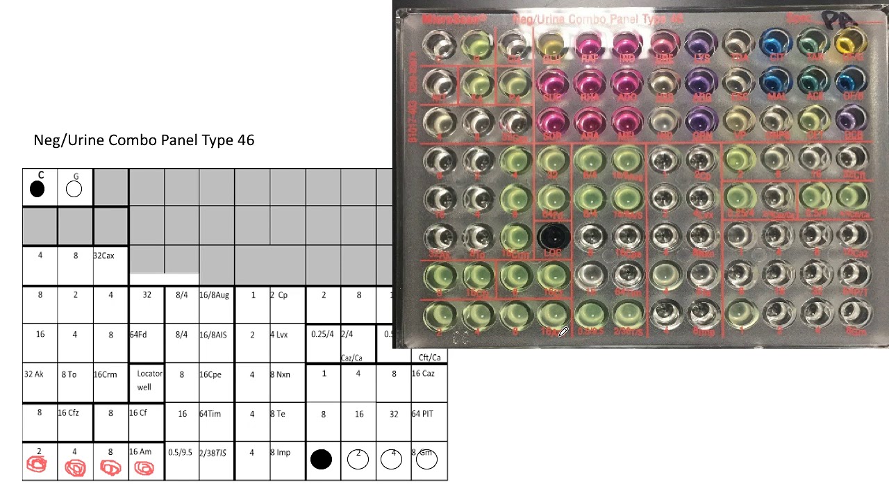 Reading MICs from microtiter plate