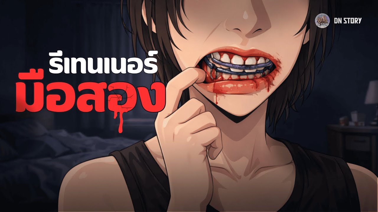 รีเทนเนอร์มือสอง | DN STORY