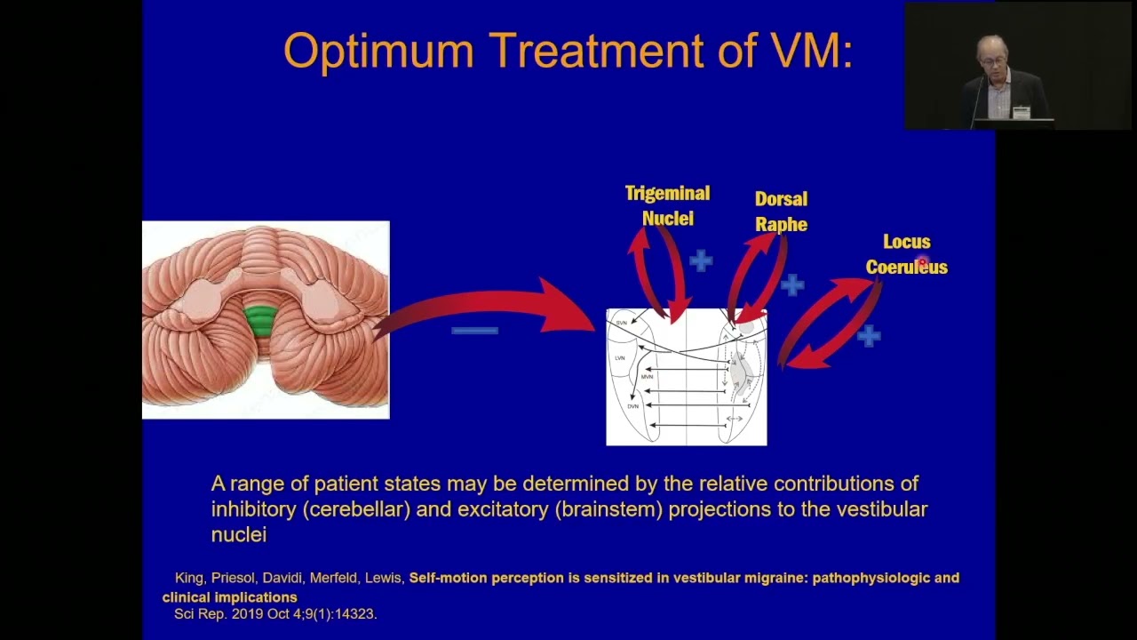 Vestibular Migraine Management  Practical Strategies for Patient Buy In and Treatment
