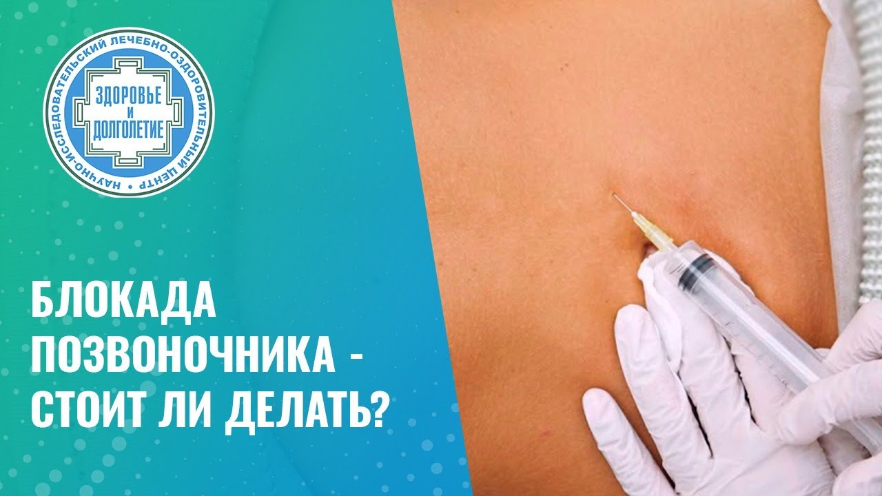 👉 Блокада позвоночника - стоит ли делать?