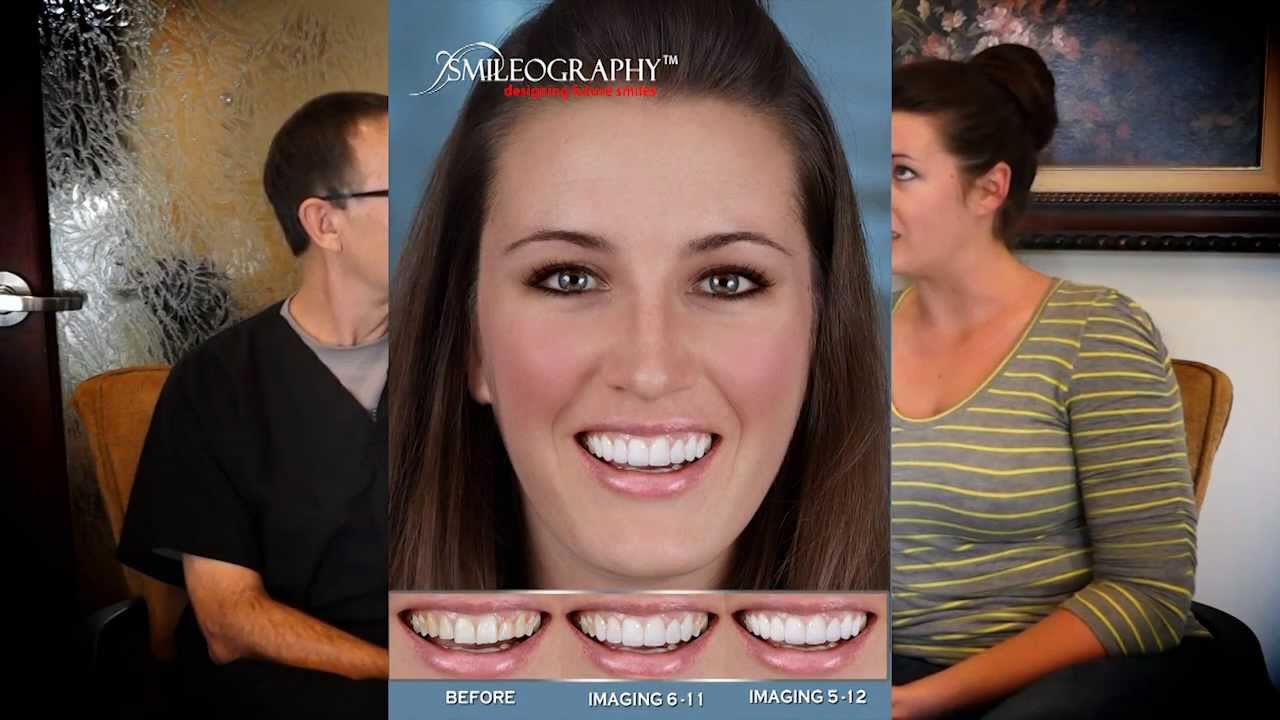 Smileography case acceptance